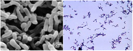 Bacteria causante del acné
