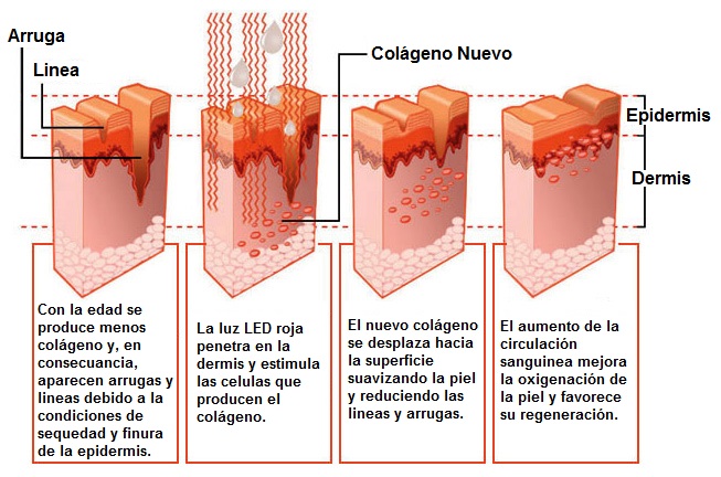 Reducción de las arrugas
