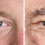 Tratamientos antiedad con LED rejuvenecimiento facial con led